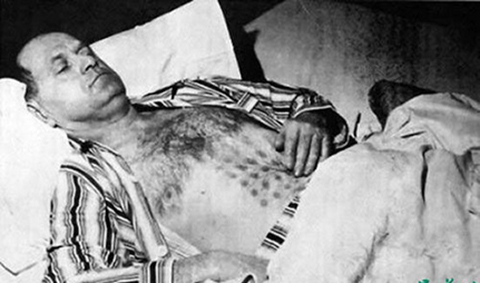 1967年猎鹰湖事件加拿大男子触摸“UFO”后饱受折磨，真实UFO事件
