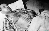 1967年猎鹰湖事件加拿大男子触摸“UFO”后饱受折磨，真实UFO事件